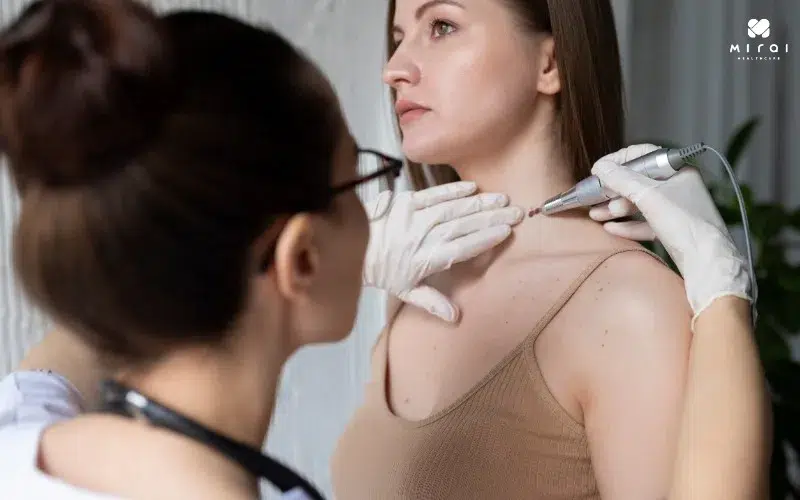 sinh-thiet-tuyen-giap-xac-dinh-benh-lanh-tinh-hay-ac-tinh