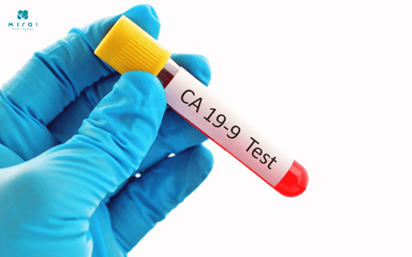 cac-chi-so-xet-nghiem-ung-thu-da-day-ca-19-9