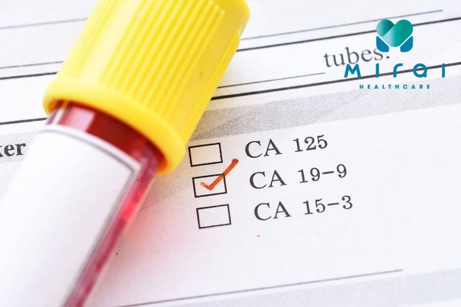 xet-nghiem-ca-19-9-tam-soat-mot-so-ung-thu-khac