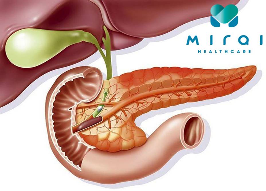xet-nghiem-ca-19-9-trong-phat-hien-dieu-tri-ung-thu-tuy