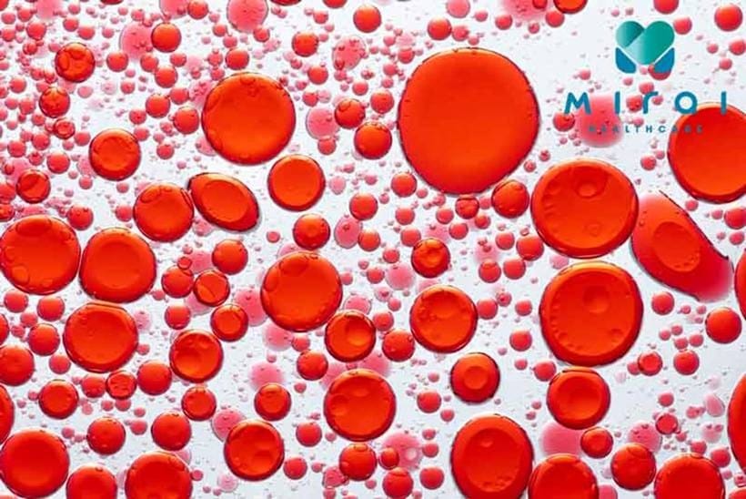 bilirubin-gian-tiep-la-gi