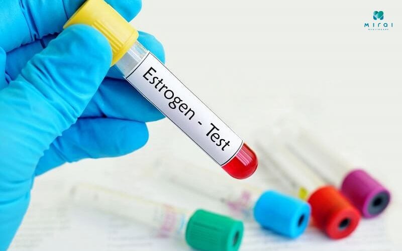 cac-xet-nghiem-noi-tiet-to-nu