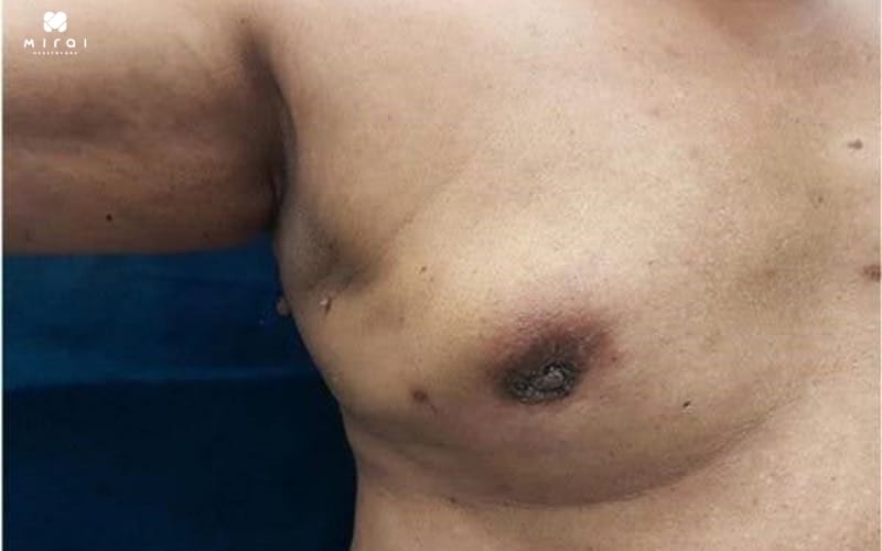 mot-so-hinh-anh-ung-thu-vu-01