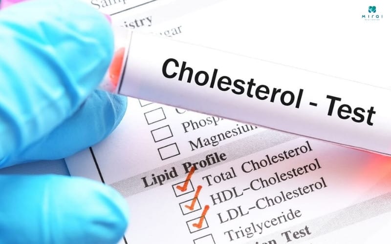 Non HDL-C nguy cơ thấp là < 130 mg/dL