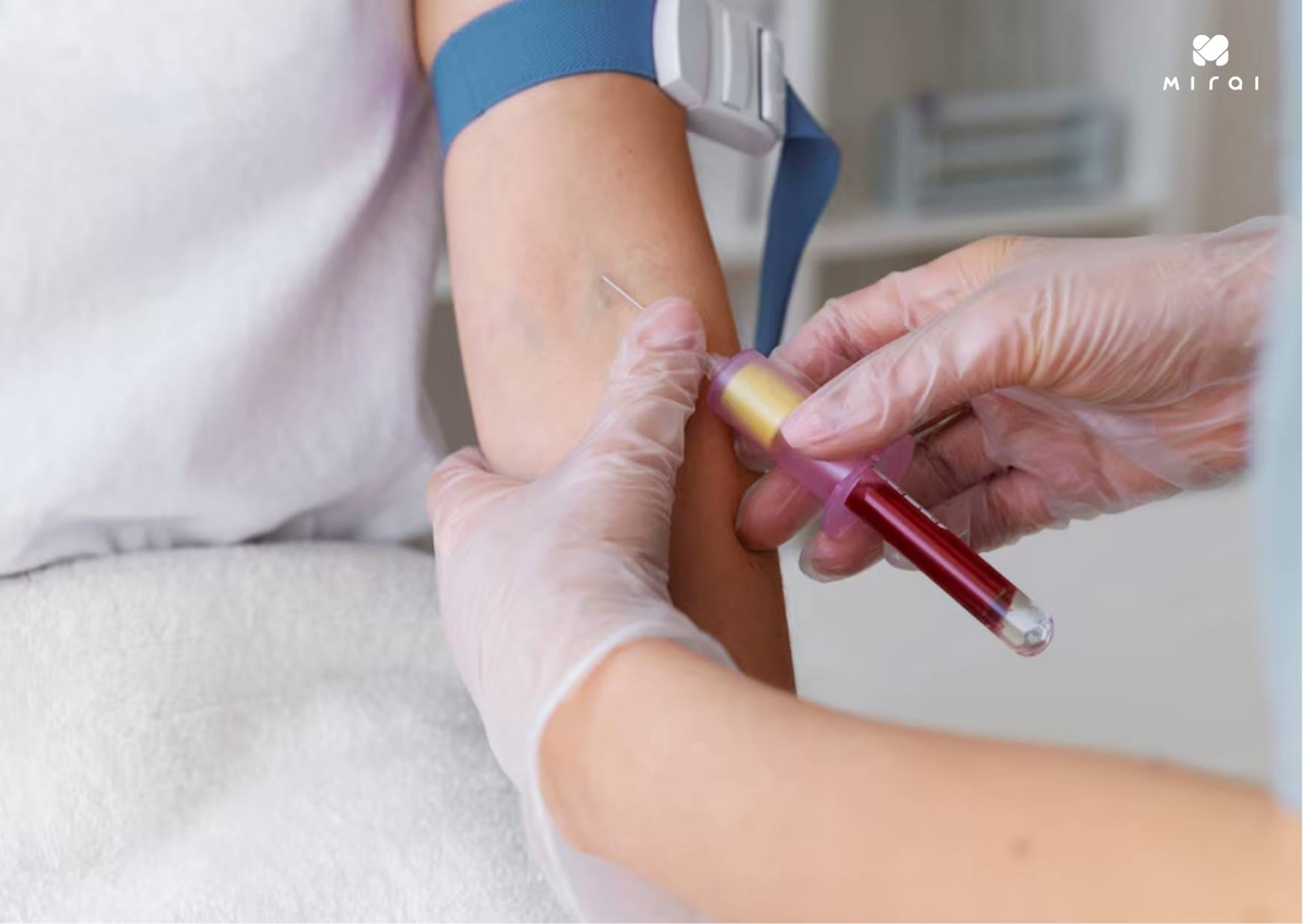 Kiểm tra lipid máu định kỳ để có phương pháp điều chỉnh phù hợp