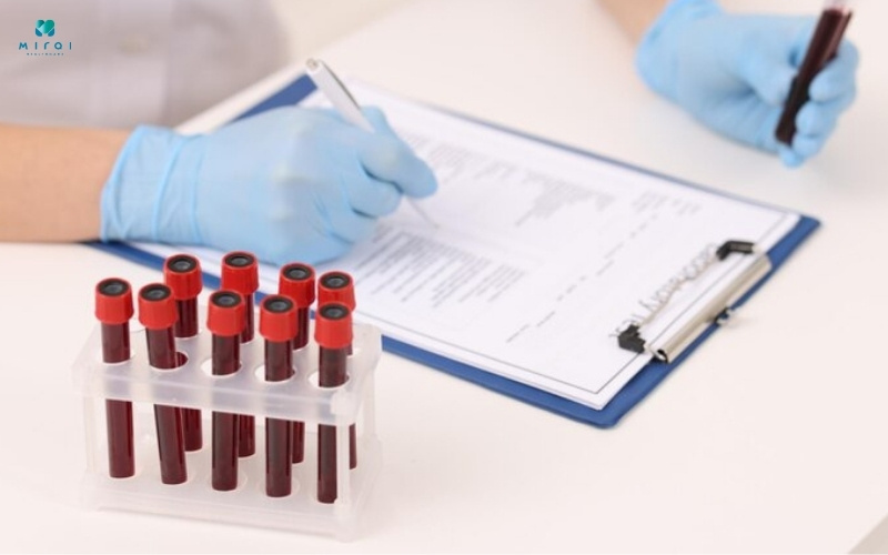 Xét nghiệm Double test có kết quả sau 1 - 7 ngày làm việc