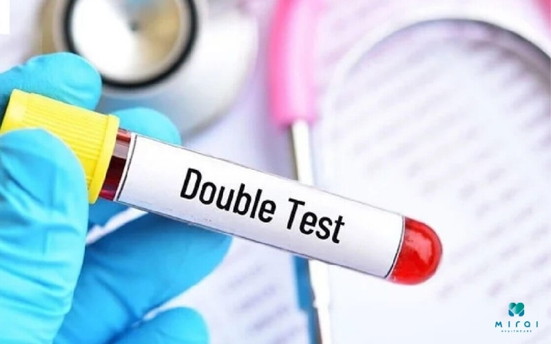 Xét nghiệm Double Test là sàng lọc nguy cơ dị tật thai nhi