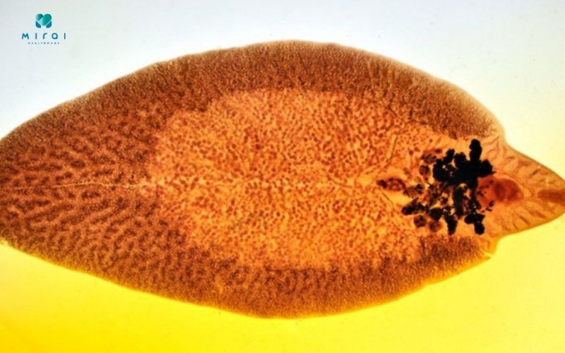 Xét nghiệm sán lá gan tìm sự hiện diện sán lá gan trong cơ thể