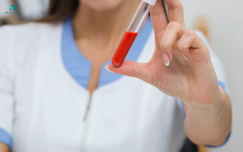 Xét nghiệm máu Elisa giúp xác định nồng độ kháng thể IgE và IgG