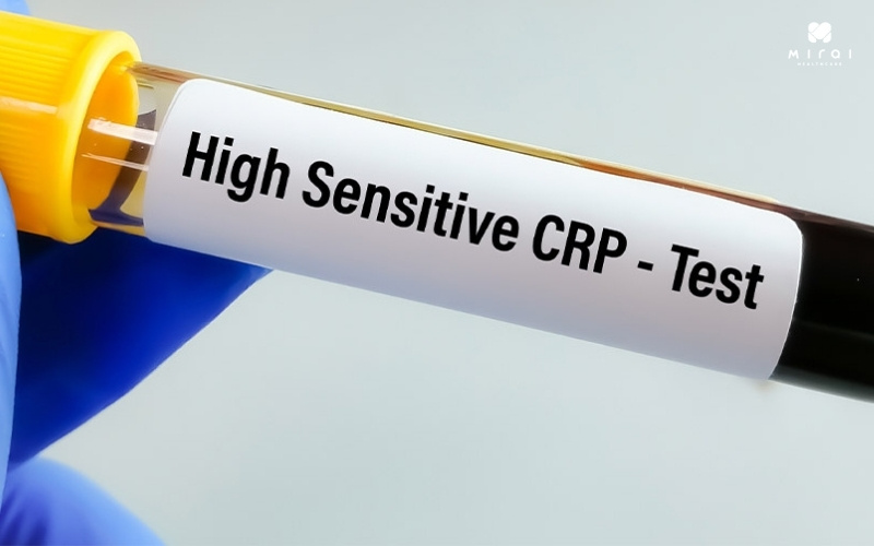 Xét nghiệm CRP-hs giúp đánh giá bệnh tim mạch và viêm