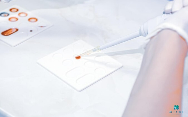 Xét nghiệm D-dimer bằng ELISA với độ nhạy và độ đặc hiệu cao