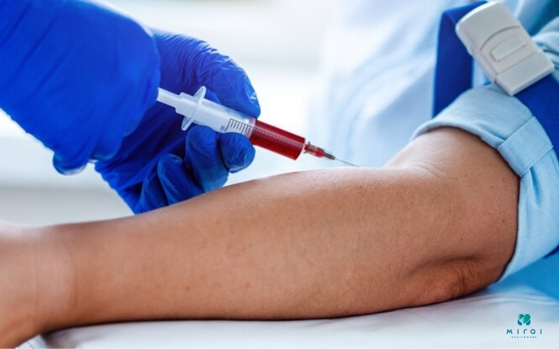 Lấy máu là một bước trong quy trình xét nghiệm folate