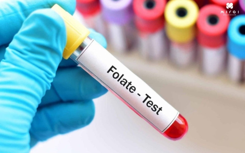 Xét nghiệm folate để đo nồng độ axit folic trong máu