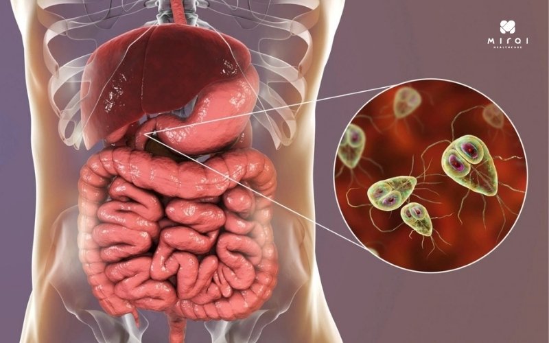 Xét nghiệm Eos để chẩn đoán nhiễm ký sinh trùng