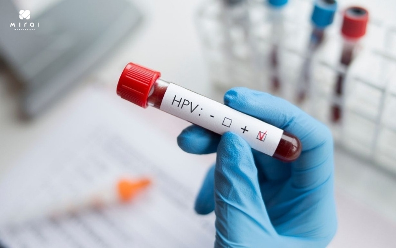 doi-tuong-nguy-co-cao-can-xet-nghiem-hpv-thuong-xuyen