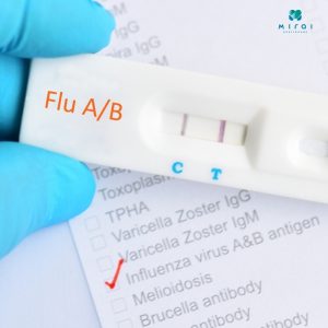 gia-test-cum-a-bao-nhieu