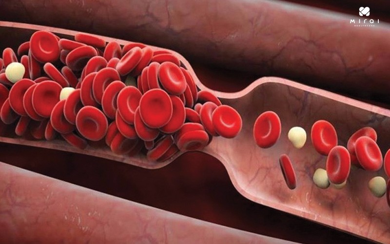 khi-nguoi-lon-tuoi-sot-cao-can-chu-y-dac-biet