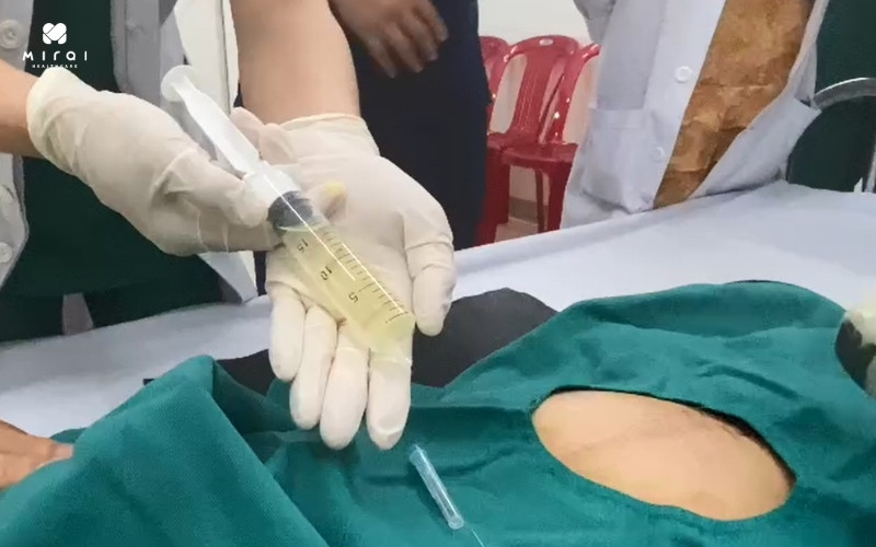 neu-ket-qua-nipt-goi-y-nguy-co-cao-co-the-thuc-hien-choc-oi