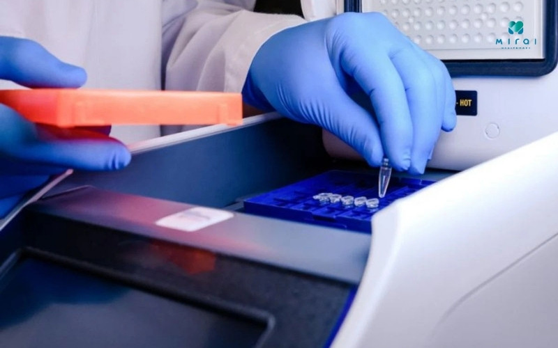 test-pcr-chan-doan-cum-a-chinh-xac-voi-do-nhay-cao