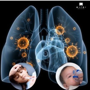 trieu-chung-viem-phoi-o-tre-em