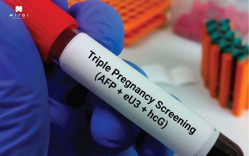 triple-test-do-nong-do-ba-chat-sinh-hoa-quan-trong-trong-mau-me