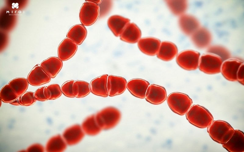 xet-nghiem-aslo-giup-xac-dinh-nhiem-trung-lien-cau-khuan