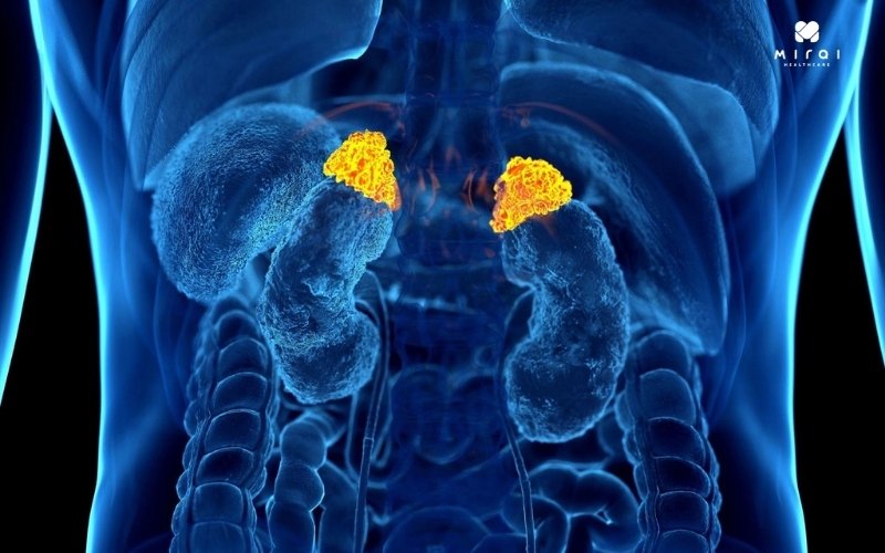 xet-nghiem-catecholamine-chan-doan-khoi-u-tuyen-thuong-than