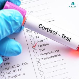 xet-nghiem-cortisol-doi-voi-hoi-chung-cushing-suy-thuong-than