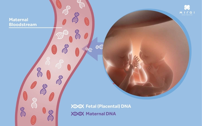 xet-nghiem-nipt-giup-phat-hien-hoi-chung-down-edwards-patau