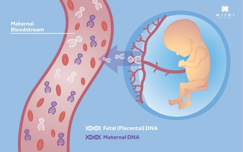 xet-nghiem-nipt-giup-sang-loc-di-tat-thai-nhi