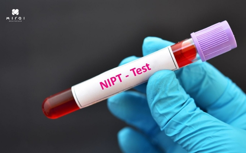 xet-nghiem-nipt-voi-muc-dich-chinh-sang-loc-di-tat-thai-nhi