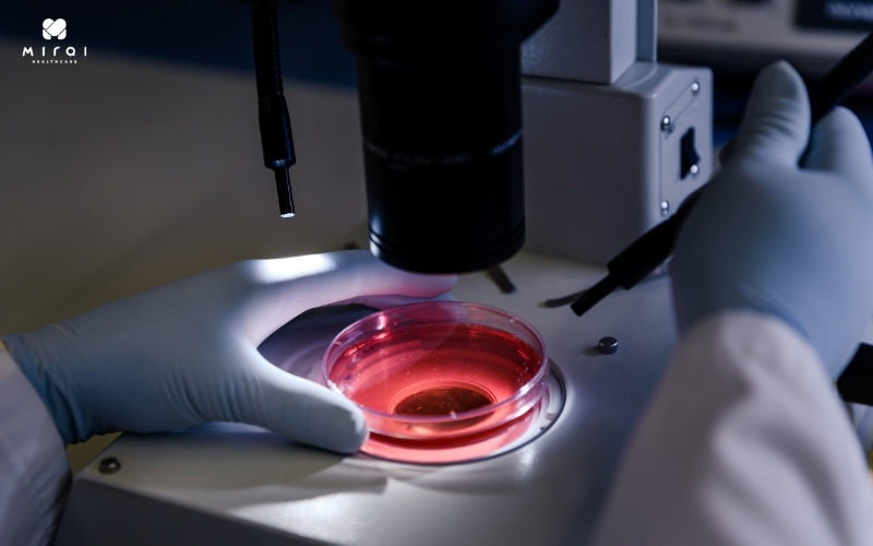 xet-nghiem-phet-mau-ngoai-bien-danh-gia-kich-thuoc-hong-cau