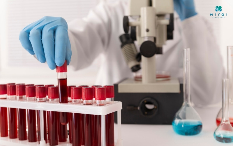 xet-nghiem-phet-mau-ngoai-bien-khi-nghi-ngo-benh-ly-mau