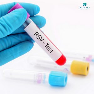 xet-nghiem-rsv-phat-hien-virus-hop-bao-ho-hap-o-tre-nho