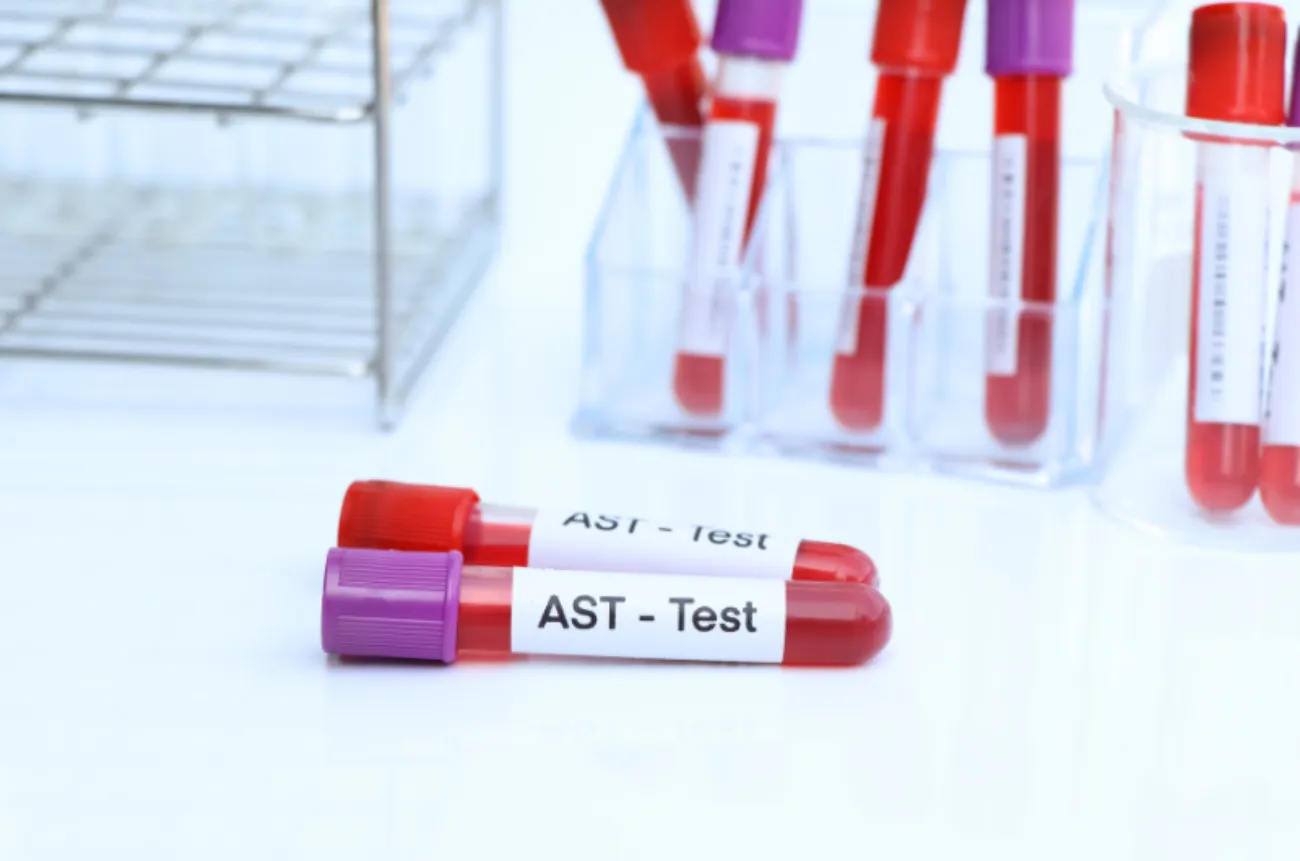 ALT, AST tăng cao
