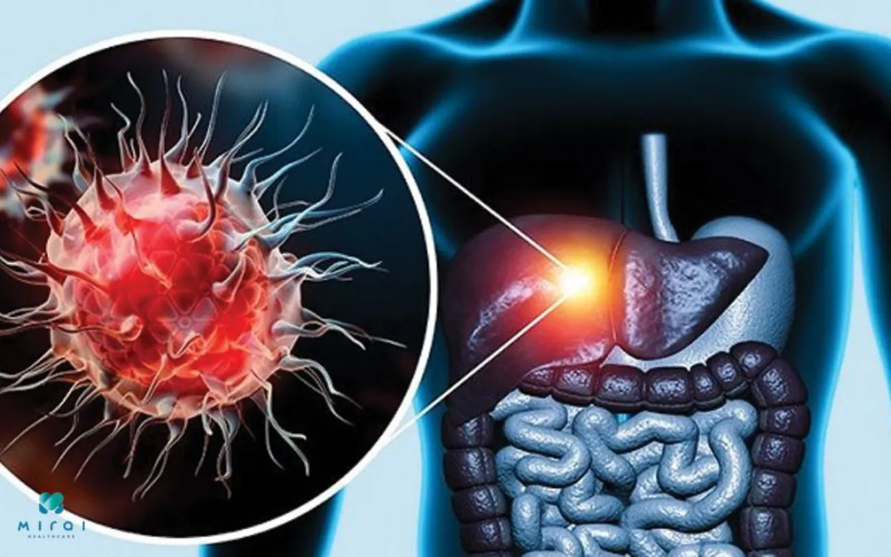 Viêm gan B có thể tồn tại lâu dài trong cơ thể mà không biểu hiện rõ ràng