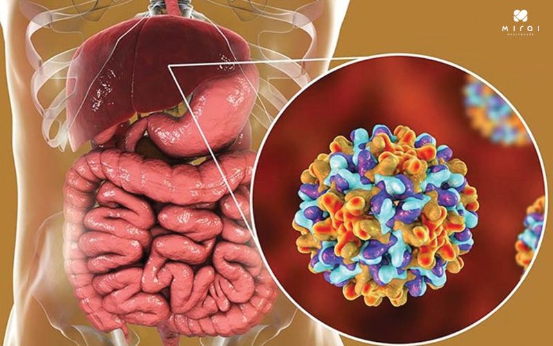 Viêm gan B dễ bị bỏ qua và tiến triển bệnh trở nên nguy hiểm