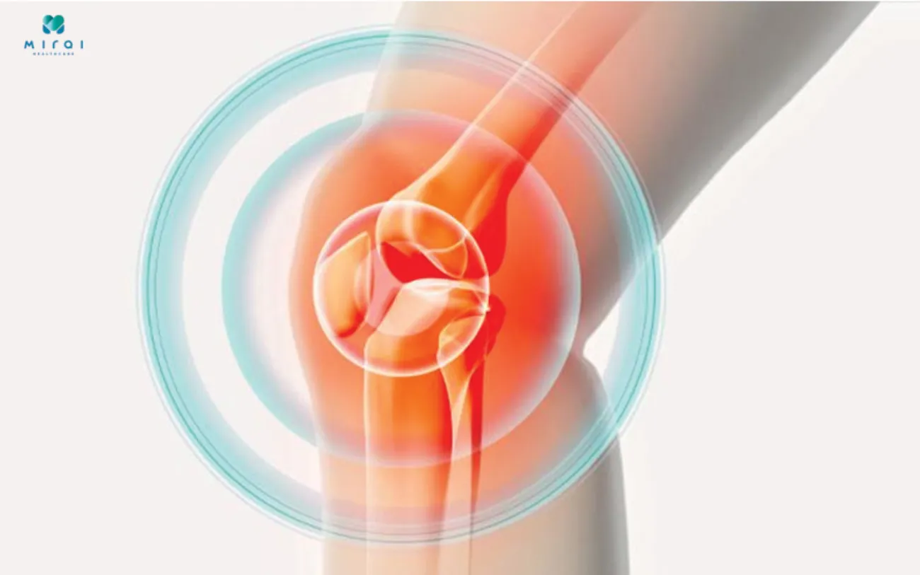 Khớp gối đau nhức, khó vận động