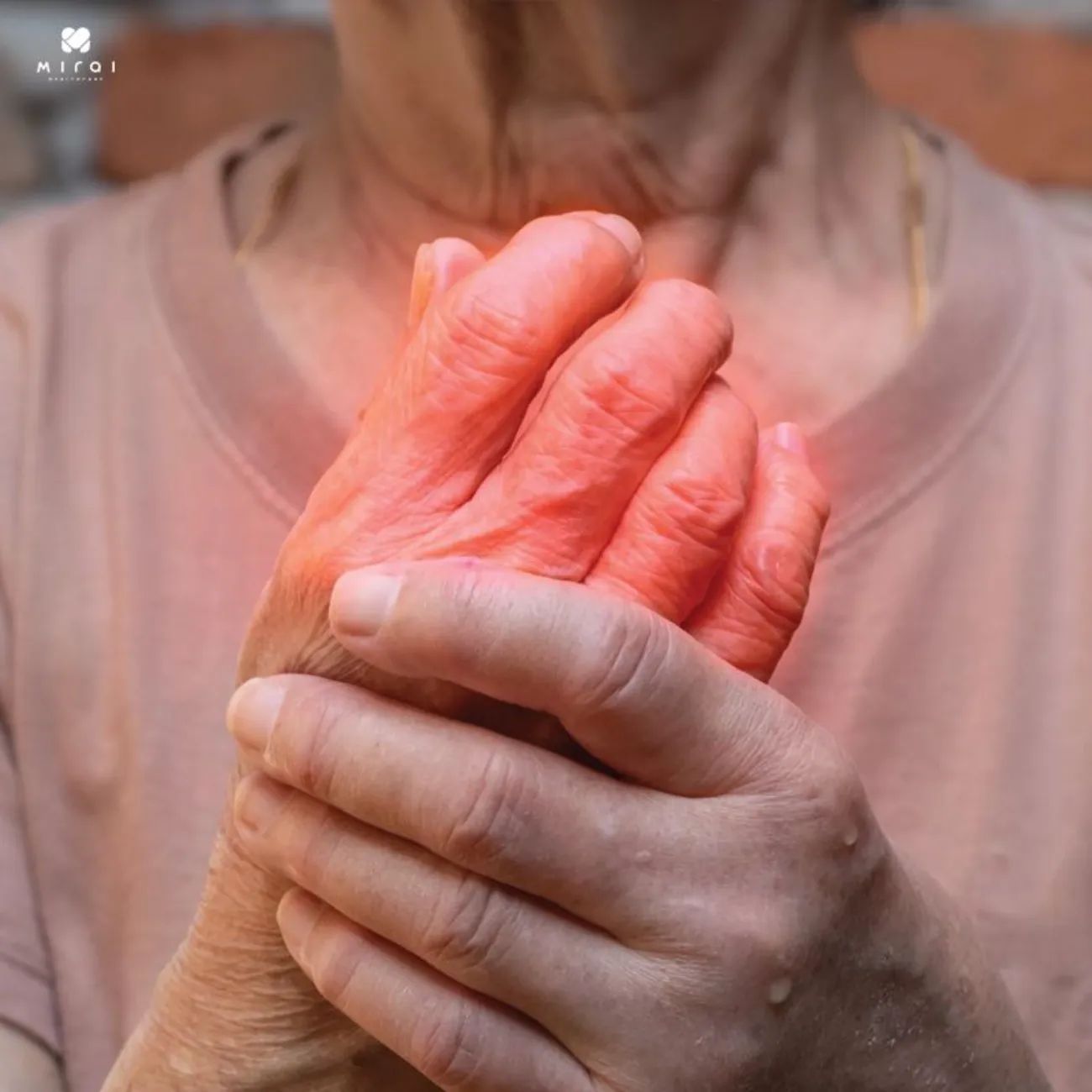 Viêm khớp dạng thấp có chữa dứt điểm được không