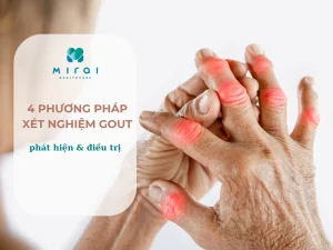xet-nghiem-gout