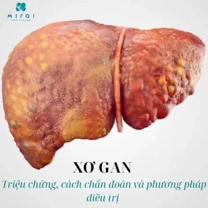 xo-gan