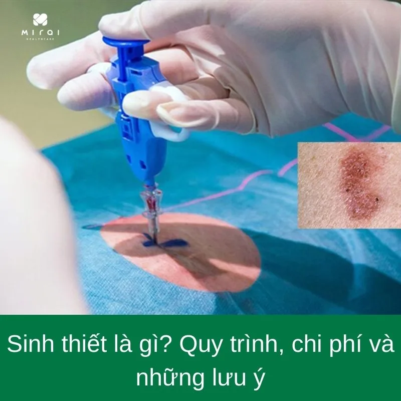 sinh-thiet-la-gi
