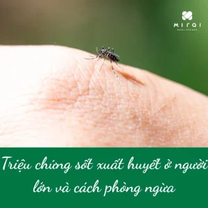 trieu-chung-sot-xuat-huyet-o-nguoi-lon