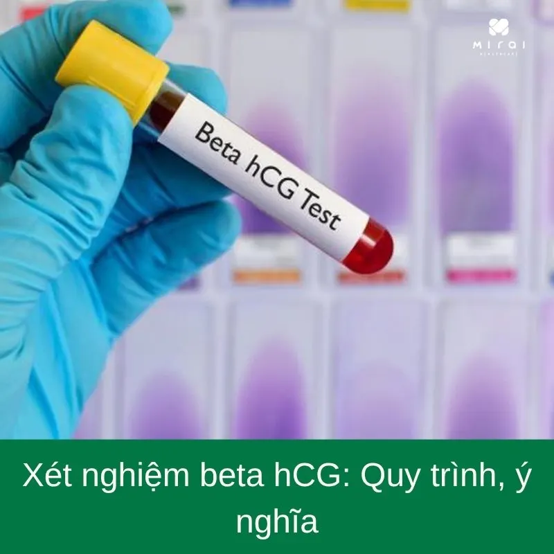 xet-nghiem-beta-hcg
