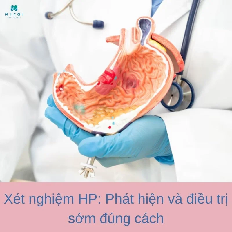 xet-nghiem-hp