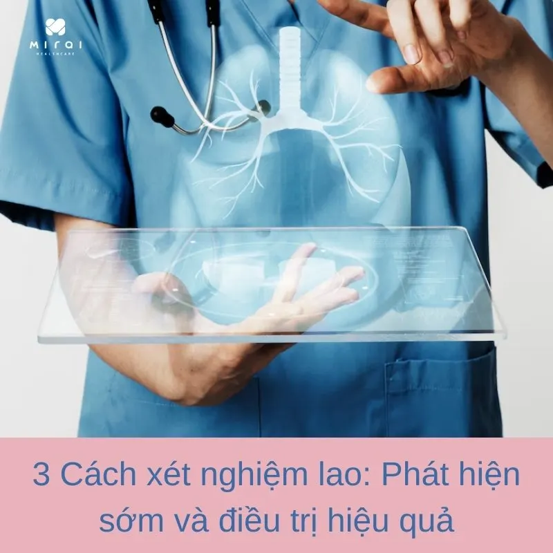 xet-nghiem-lao