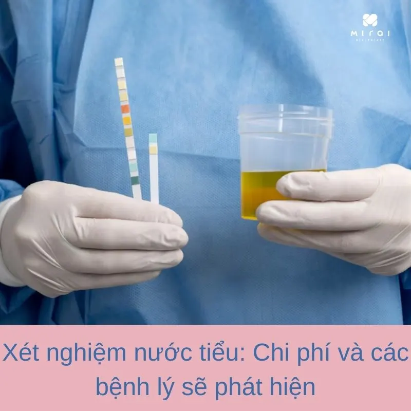 xet-nghiem-nuoc-tieu