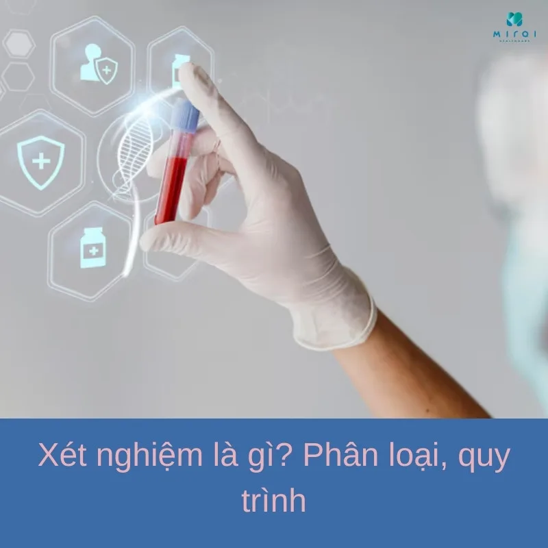 xet-nghiem