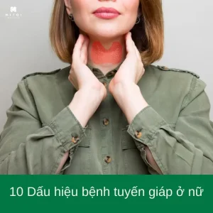 dau-hieu-benh-tuyen-giap-o-nu