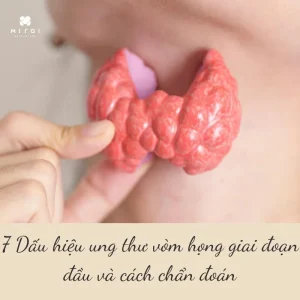 dau-hieu-ung-thu-vom-hong-giai-doan-dau